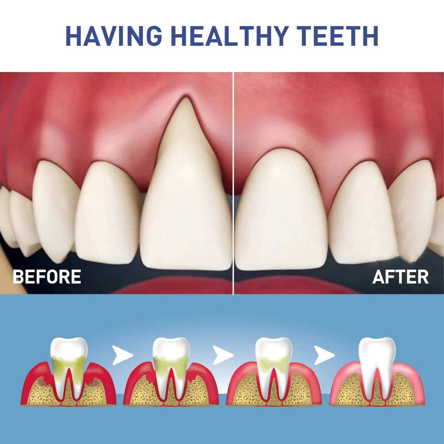 Say goodbye to the worries of gum issues and hello to a brighter, more confident smile with the West&Month Gum Care Gel for Pain Relief and Whitening.